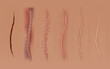 © designer_things - Set of healing wounds, skin scars, stitched gash and cuts. Realistic surgical sutures, stitched wounds at different healing stages isolated on human skin background