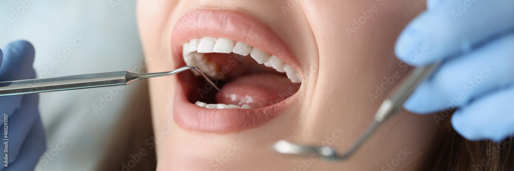 Dentist examines oral cavity of woman patient