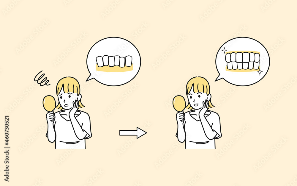 歯並びを気にする若い女性 歯の悩み コンプレックス 治療 歯列矯正 矯正後 イラスト素材 Wall Mural Senryu