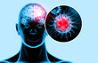 Virus attacking the human brain. Viral disease. 3d illustration