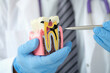 © H_Ko - Doctor dentist showing pen on carious cavity on artificial plastic model of tooth closeup