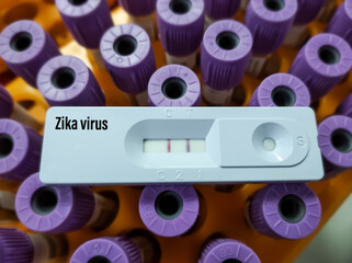 Wall Mural - Rapid test cassette for Zika virus test, positive result view, selective focus