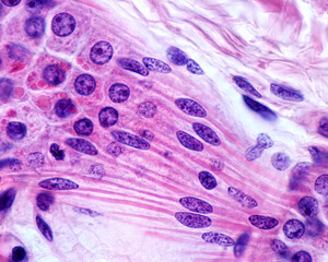 Poster - Apocrine sweat gland.Myoepithelial cells