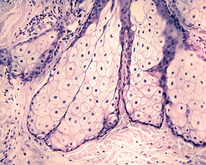 Poster - Human skin. Sebaceous gland