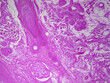 Microscope histology image of a hair follicle showing sebaceous and eccrine sweat glands (100x)