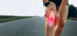 © Miha Creative - Joint  problems and tendon inflammation. Sporty woman who suffered a knee accident during the run.
