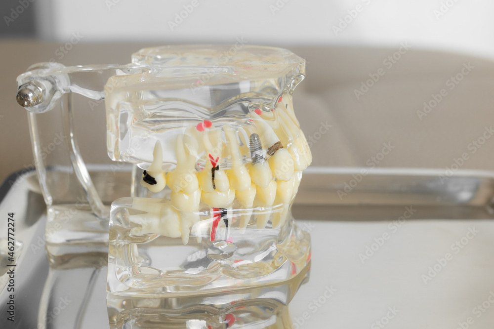 orthodontic model and dentist tool - demonstration teeth model of ...