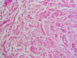 © DrWD40 - Histology microscope image of dense irregular connective tissue proper in dermis (400x)