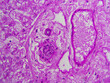 Histology microscope image of vein, artery, and bile duct in the liver (400x)
