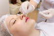 © Roman - The cosmetologist rubs the girl's lips with oil for care after the lip augmentation procedure with hyaluronic acid