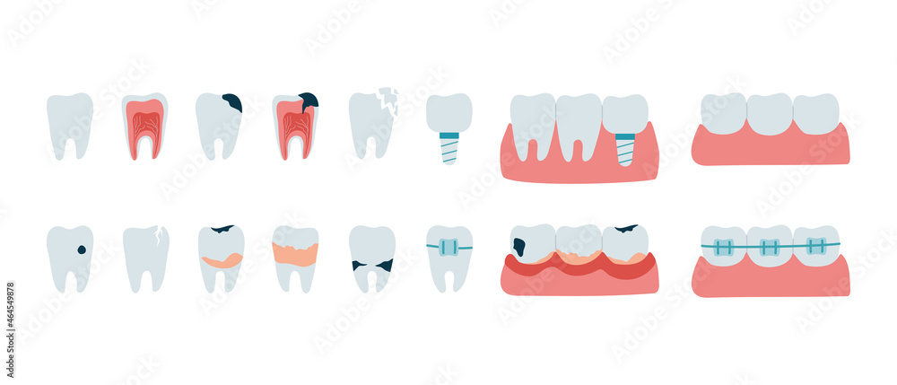 Set of teeth with dental diseases. Oral problems, caries, tartar ...