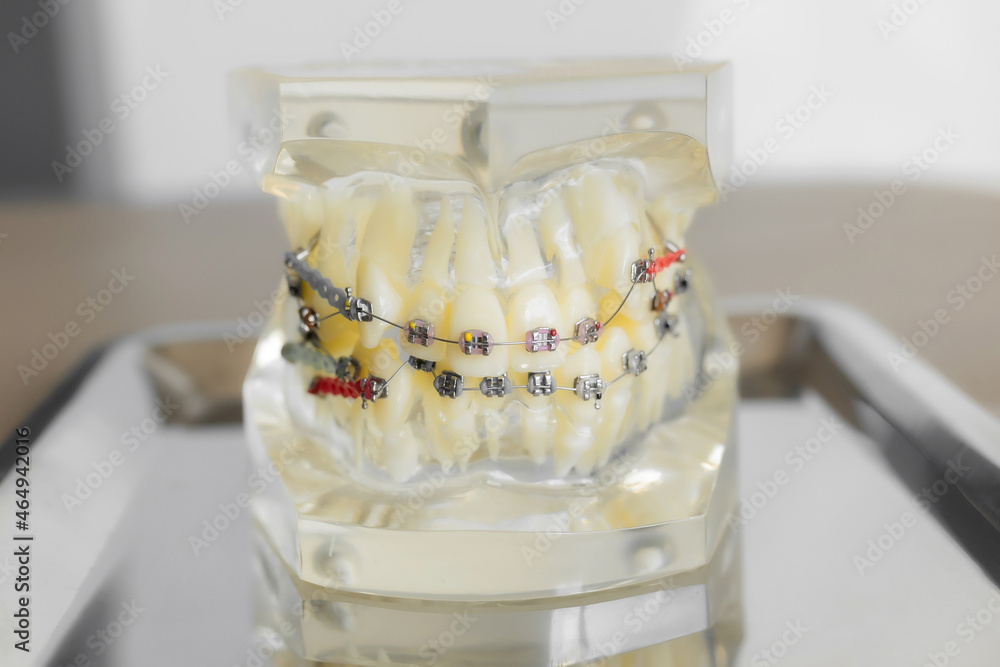 orthodontic model and dentist tool - demonstration teeth model of ...