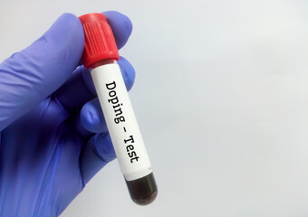 Poster - Doctor holding test tube with blood sample for Doping test, copy space. closeup. Doping control