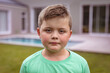 © wavebreak3 - Portrait of caucasian boy with blank expression standing at backyard outside house