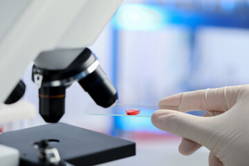  Scientist holding microscope slide with sample of red liquid in laboratory, closeup