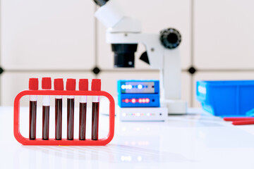 Sticker - Blood test for hormones and microelements in a biochemical laboratory. Test tubes with blood in the hand of a laboratory assistant and a microscope on the background