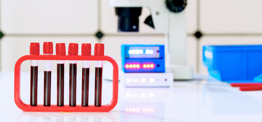 Sticker - Blood test for hormones and microelements in a biochemical laboratory. Test tubes with blood in the hand of a laboratory assistant and a microscope on the background