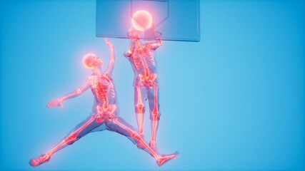 Sticker - basketball game players with visible bones