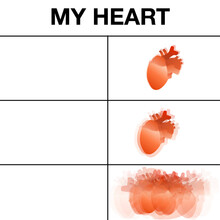 Viral Exploding Heart Internet Meme For Commercial Use With The Text 'My Heart'. Online Social Media Joke Or Meme. Corporate, Commercial, Product Appropriate