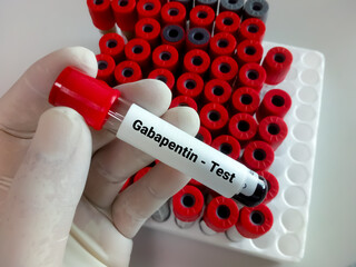 Canvas Print - Blood sample for Gabapentin test.  Set therapeutic dose. Epilepsy, seizures.