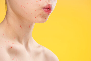 female face closeup red dots dermatology rash