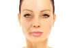 Plastic Surgery Results,Nasolabial folds,Neck ,Under eye circles,neck lines.