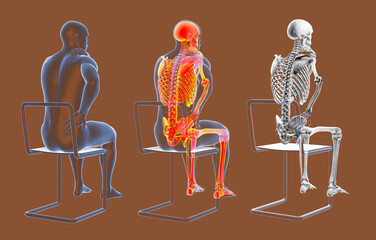 Poster - Human spine pain, backache, back pain