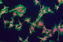 Fibroblast Cells