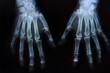 X-ray photograph of human hands on black background