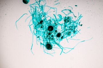 Wall Mural - Characteristics of Rhizopus is a genus of common saprophytic fungi on Slide under the microscope for education.
