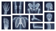 © Aleksandr - Collection different human body parts roentgen pictures vector flat illustration. Set x rays shot