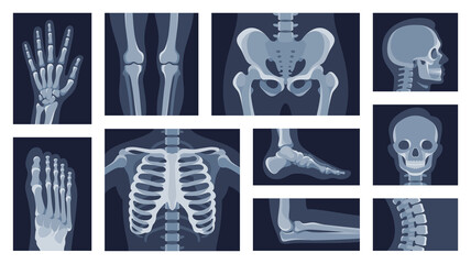 Collection different human body parts roentgen pictures vector flat illustration. Set x rays shot