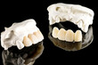 © sujit - Closeup / Prosthodontics or Prosthetic / Tooth crown and bridge implant dentistry equipment and model express fix restoration.