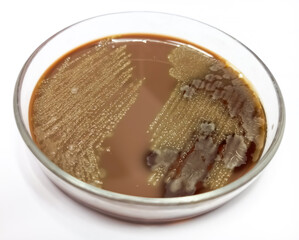 Canvas Print - Staphylococcus aureus: Gram-positive bacteria, nonmotile, beta hemolysis, Staphylococcus growth on chocolate agar media.