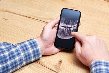 Man analyzing an x-ray picture of his teeth with an implant at home. Dental clinic and orthodontic treatment