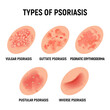 Psoriasis rash vector skin hand infection background. Psoriasis dermatitis eczema cartoon illustration