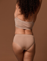 Rear view of an unrecognizable woman in beige underwear with skin problems and overweight. Dermatology, body positivity, love acceptance concept. Copy space for ads