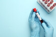 © New Africa - Scientist holding tube with blood sample and label STD Test on light blue background, top view. Space for text