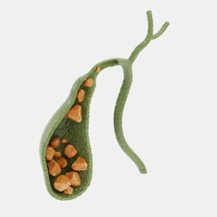 Sticker - Realistic 3D Render of Gallbladder