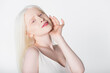 Smiling albino model looking at camera isolated on white.