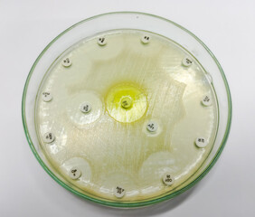 Wall Mural - Antimicrobial susceptibility testing in culture plate. Drug sensitivity test, disk drug, antibiotic sensitivity. All basic usable antibiotic are sensitive eccept Levofloxacin antibiotic.