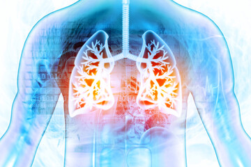 Wall Mural - Lung disease in human body