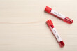Tubes with blood samples and labels STD Test on white wooden table, flat lay. Space for text