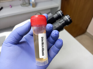 Poster - Urine Sample for Urine Microalbumin test with laboratory background. Closeup. Urinalysis. selective focus