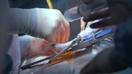 Wall Mural - Closeup of professional doctor hands operating a patient during open heart surgery in surgical room. Healthcare and medical intervention concept