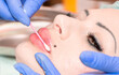 © Vera - Lip augmentation. Beautician injects hyaluronic acid into the lips of a girl with a syringe. The cosmetologist doctor performs the procedure in the cosmetology office. Plastic surgery.