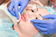 © Vera - Lip augmentation. Beautician injects hyaluronic acid into the lips of a girl with a syringe. The cosmetologist doctor performs the procedure in the cosmetology office. Plastic surgery.