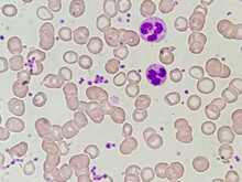 Blood Smear Microscopic Show Platelet, Neutrophil, Red Blood Cell And Polychromatic In The Peripheral Blood Of Cat With Regenerative Anemia.
