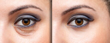 Before And After Makeup Looks Concealing The Dark Circles