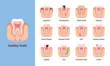 Teeth Problems. Medical Infographic Illustrations With Bad Commons Dental Placard Oral Bacteria And Prevention Methods Garish Vector Pictures